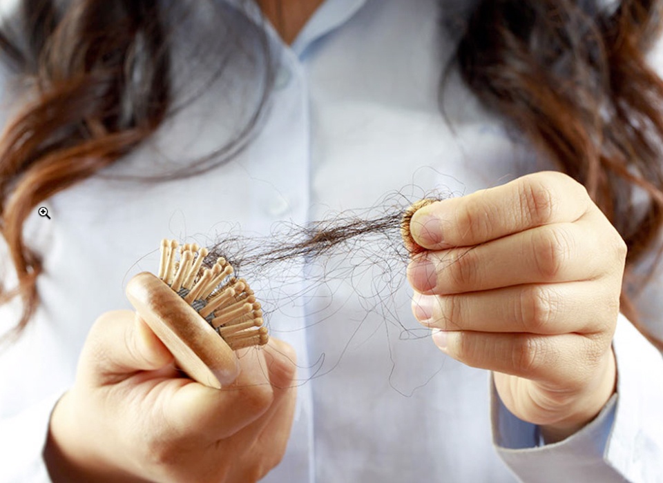 Achtung Haarausfall – das sind die häufigsten Ursachen