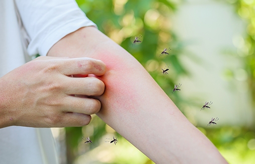 Insektengiftallergie - Alles über die Krankheit im Orbisana Ratgeber erfahren