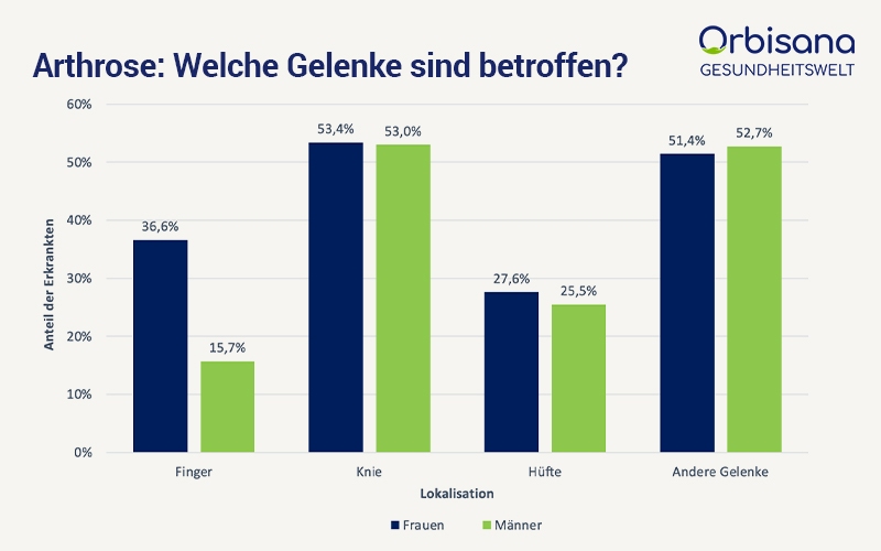 Betroffene Gelenke bei Arthrose