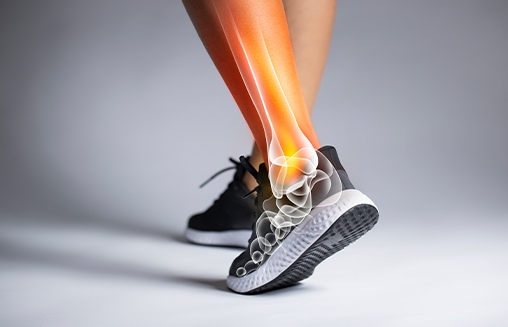 Schuhtechnik im Sanitätshaus von Orbisana – online und vor Ort!